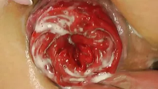 Blue Dress Sexy Fisting and Prolapse by Hotkinkyjo