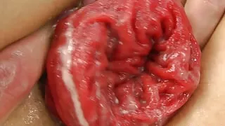 Dig with Fist in the Ass & Anal Prolapse by Hotkinkyjo