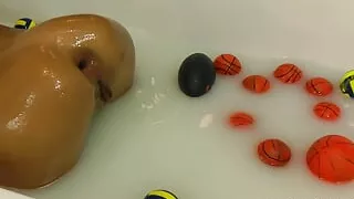 Milk Tube Ball Birth and Prolapse