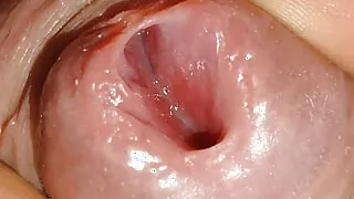 Reanimation of the stick with small electric shocks on the USB cable