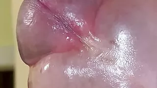 Fill the foreskin with saline until orgasm