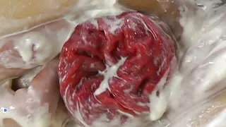 Fist Fuck Banana Split & Prolapse by Hotkinkyjo