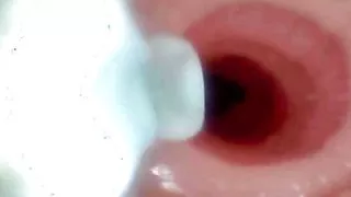 A detailed examination of Lopuza93 oral cavity and anal area using an endoscope camera.