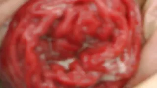 Zebra Sexy Self Anal Fisting & Prolapse