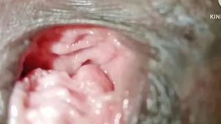 Desi Indian bhabhi's chut was torn and kept deep hole chut