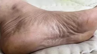 My feet after sports