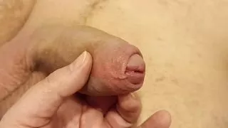 Examining a large penis