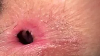 Stepdaughter Farted in My Nose. Hm I Didn't Think She Wants My Inheritance