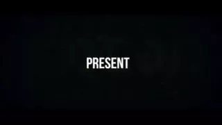 Huge Booty Colombian Albino Midget