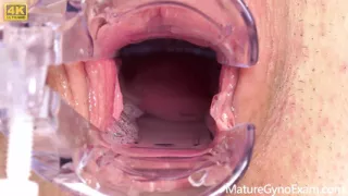 Cervix of Shy MILF Revealed!