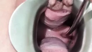 Milf Julie plays with her cervix