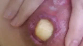 Anal insertion with a cute apple