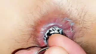 Butplug Bonanza part 1 ???? (Painfull butplug removal)