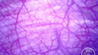 Extreme Bulge inside POV of my Bladder and Urethra