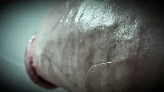 why is my pee hole always so damp?