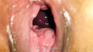 18 year old Teen Got Cute Pussy Moles Close Up Open Wide