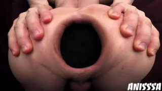 Sexy Round Ass With Stretched Hole