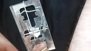 Micropenis and a mousetrap. Hurt and it changed color