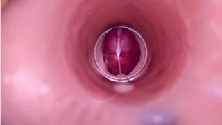 Female Insemination - Internal Camera Captures Deep Male Ejaculation