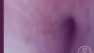 Showing you the Cum Outlets inside my Dick