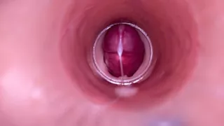 Female Insemination - Internal Camera Captures Deep Male Ejaculation