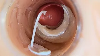 Camera inside deep pussy captures huge ejaculation of sperm