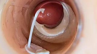 Camera Inside Deep Pussy Captures Huge Ejaculation of Sperm
