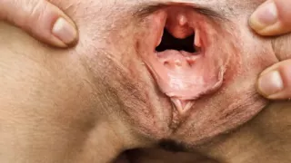 Gaping Pussy Outdoors Naked and Pissing