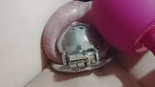 Intralockular ejaculation