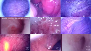 COMPILATION: Endoscope in my Dick, Ass and Bladder