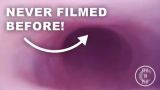 Fisrt Ever Pov Comshot From Inside The Prostate