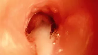 Huge Cumshot inside HOLE! BEST CUMSHOT INSIDE ANAL! ASMR