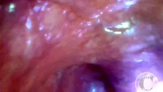 POV Extreme Deep Anal Exploration! Fast visible Heartbeat ????