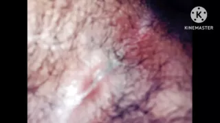 Ass closeup anal hole fingering