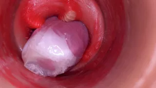 The Camera Inside the Deep Pussy Records a Huge Ejaculation with a Stuck Condom!