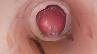 The Camera in the Deep Pussy Records a Huge Ejaculation of Sperm Into the Condom