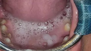 Throat Fuck with Open Mouth Gag and Spit Cum in Mouth