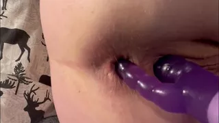 POV: Awx Machine DP