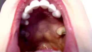 Big Wide Inside Both Girls Mouths