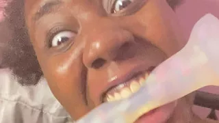 StoryTime + Bartholin Cyst Update - I Need A Doctor Surgeon HELPP