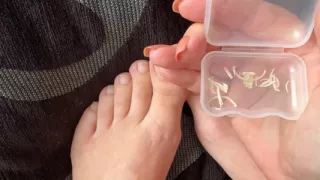 Clipped toenails for you