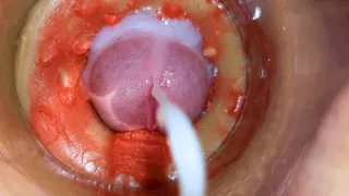 Camera Inside Deep Pussy Captures Huge Ejaculation of Sperm 4K