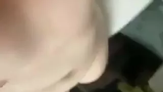 Amputee girl showing off her body