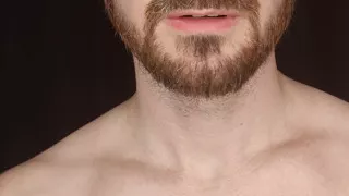 Albinoadonis