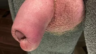 Uncut flaccid penis up close, right in your face.