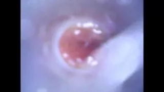 View Inside Cock While Jerking and Cumshot ( Camera Inside Dick )