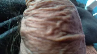 Amazing wrinkled foreskin