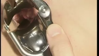 Hot German sluts getting asses fucked hard in the hospotal