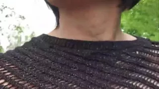 Caught by a Jogger