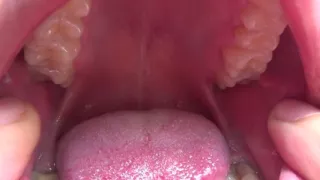 Kate open her mouth wide for you